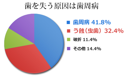 歯を失う原因は歯周病