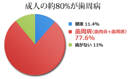 成人の約80%が歯周病